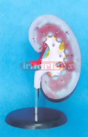 GIANT KIDNEY (1 PC) MAGNIFIED ON BASE 20cm LONG WITHOUT ADRENAL GLAND